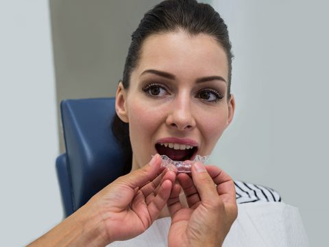 Spring Sports Call For Athletic Mouthguards