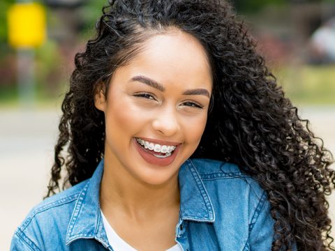 Top 8 Benefits of Using Invisalign Braces