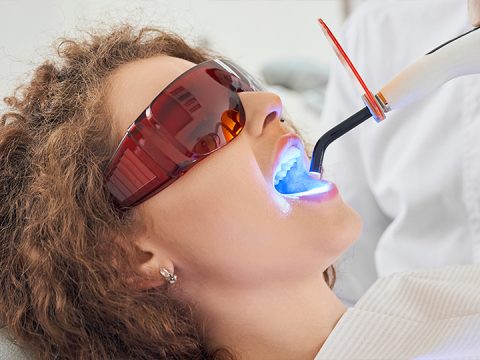 Top Benefits of Professional Teeth Whitening Treatment