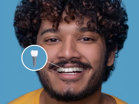 Foods to Eat and Avoid After A Dental Implant Surgery